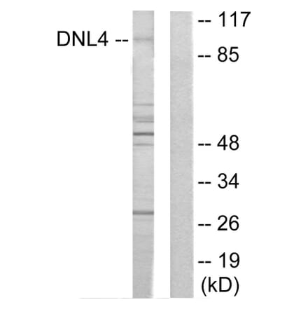 Western Blot - Anti-DNL4 Antibody (C13046) - Antibodies.com
