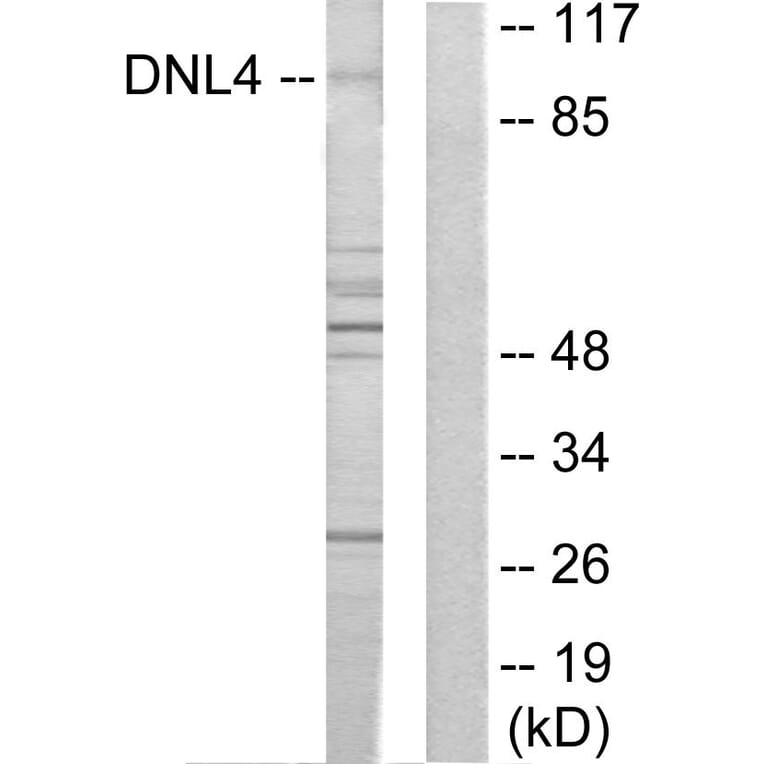 Western Blot - Anti-DNL4 Antibody (C13046) - Antibodies.com