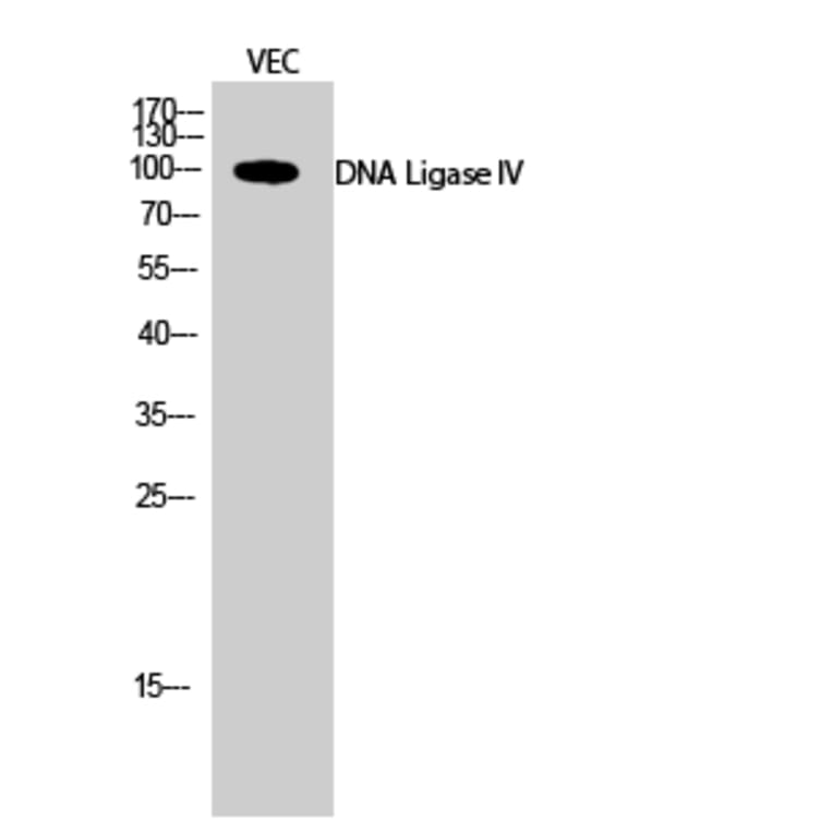 Western Blot - Anti-DNL4 Antibody (C13046) - Antibodies.com