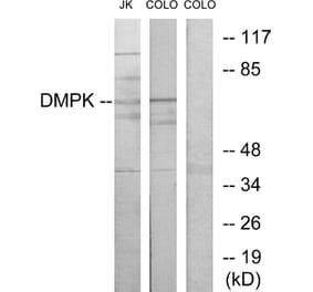 Western Blot - Anti-DMPK Antibody (C10910) - Antibodies.com