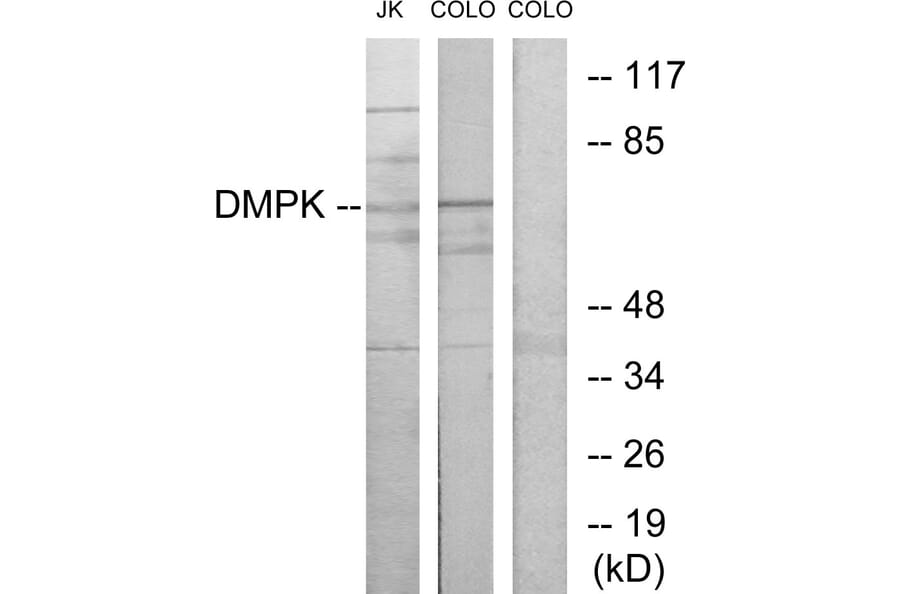 Western Blot - Anti-DMPK Antibody (C10910) - Antibodies.com
