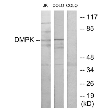 Western Blot - Anti-DMPK Antibody (C10910) - Antibodies.com
