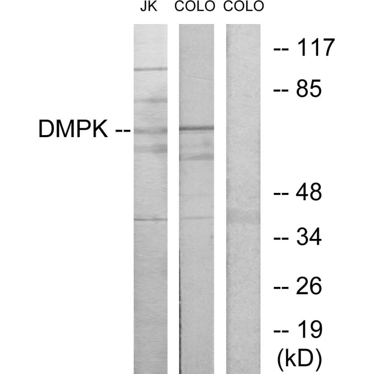 Western Blot - Anti-DMPK Antibody (C10910) - Antibodies.com
