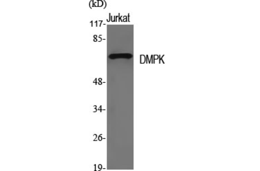 Western Blot - Anti-DMPK Antibody (C10910) - Antibodies.com