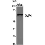 Western Blot - Anti-DMPK Antibody (C10910) - Antibodies.com