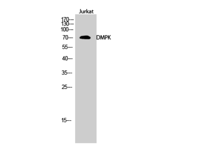 Western Blot - Anti-DMPK Antibody (C10910) - Antibodies.com