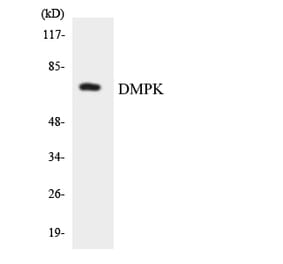 Western Blot - Anti-DMPK Antibody (R12-2704) - Antibodies.com