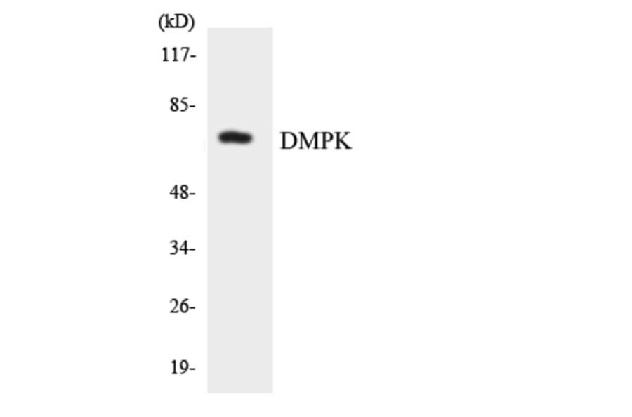 Western Blot - Anti-DMPK Antibody (R12-2704) - Antibodies.com
