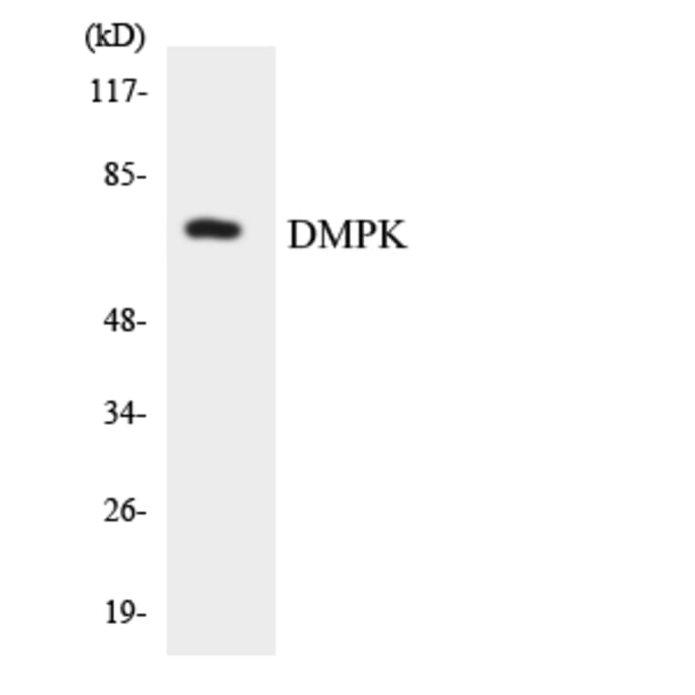 Western Blot - Anti-DMPK Antibody (R12-2704) - Antibodies.com