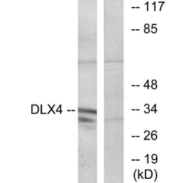 Western Blot - Anti-DLX4 Antibody (C11450) - Antibodies.com