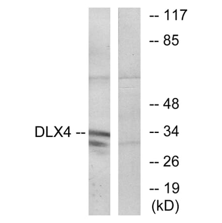 Western Blot - Anti-DLX4 Antibody (C11450) - Antibodies.com