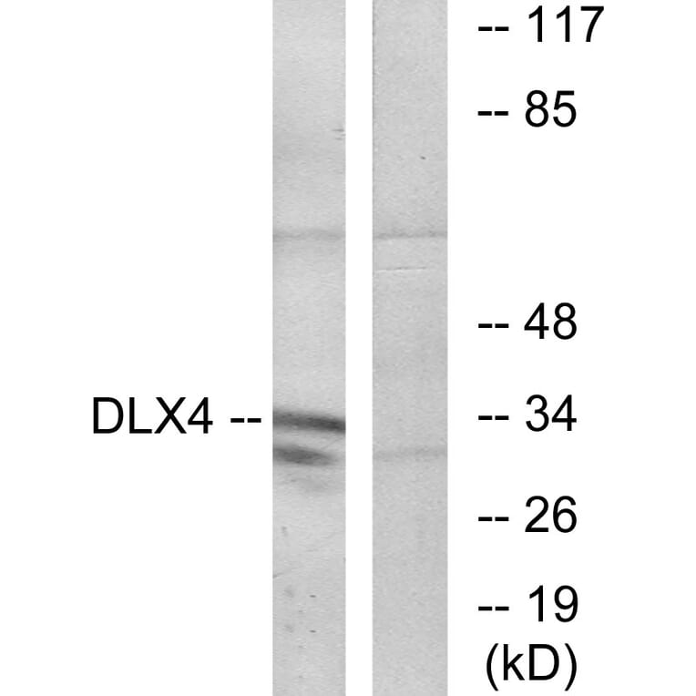 Western Blot - Anti-DLX4 Antibody (C11450) - Antibodies.com