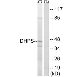 Western Blot - Anti-DHPS Antibody (C15330) - Antibodies.com