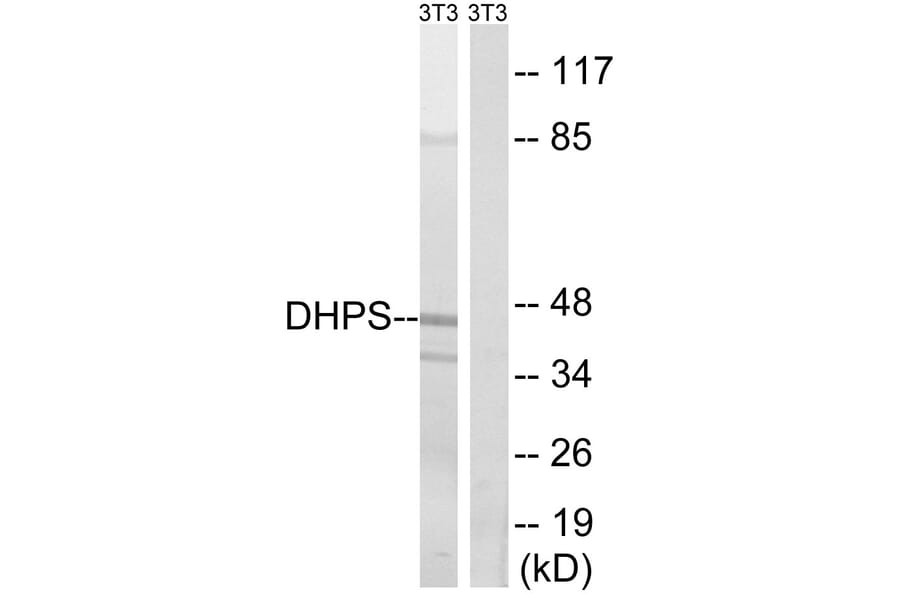 Western Blot - Anti-DHPS Antibody (C15330) - Antibodies.com