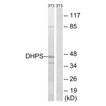 Western Blot - Anti-DHPS Antibody (C15330) - Antibodies.com