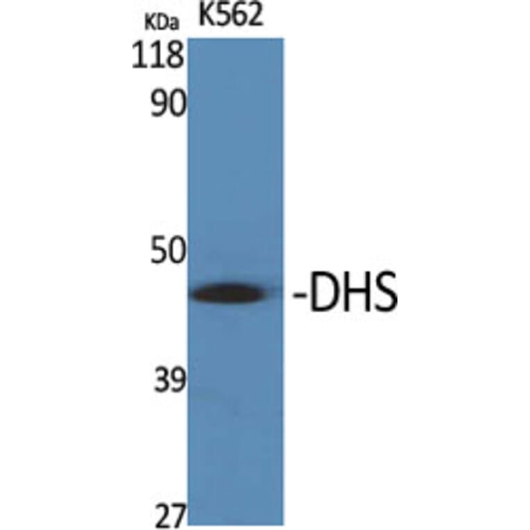 Western Blot - Anti-DHPS Antibody (C15330) - Antibodies.com