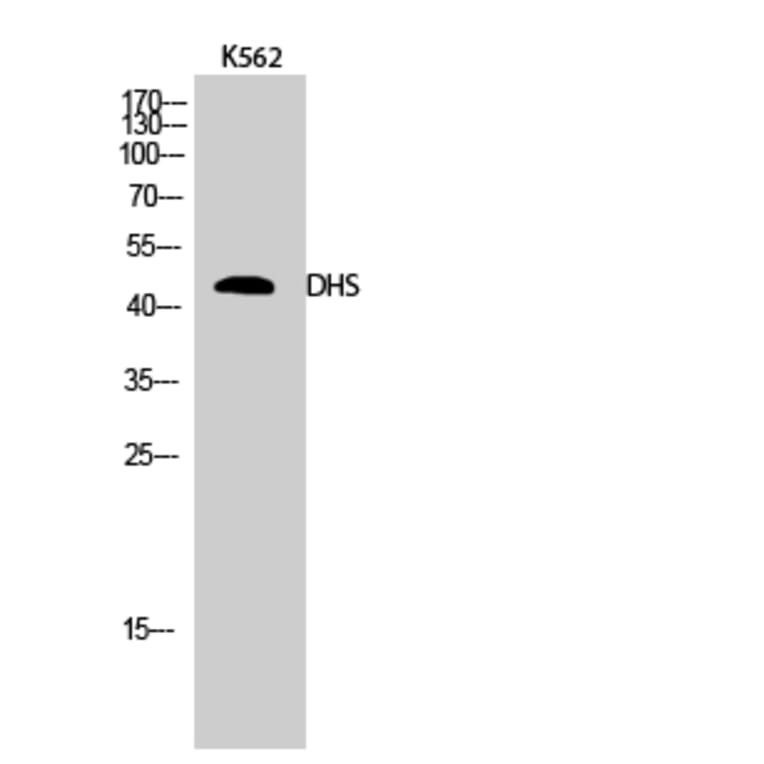 Western Blot - Anti-DHPS Antibody (C15330) - Antibodies.com