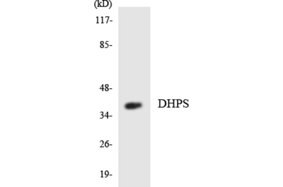 Western Blot - Anti-DHPS Antibody (R12-2695) - Antibodies.com