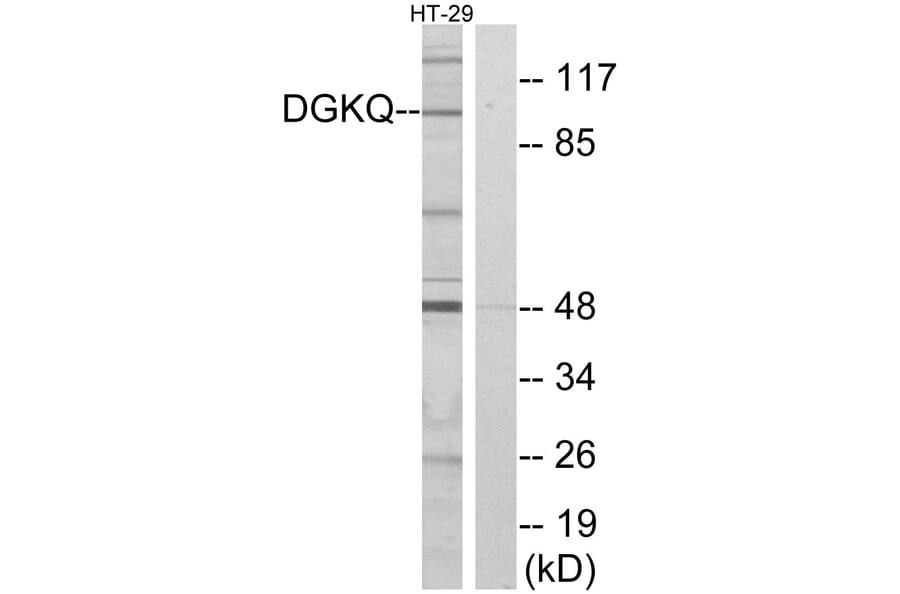 Western Blot - Anti-DGKQ Antibody (C10713) - Antibodies.com