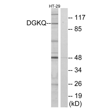 Western Blot - Anti-DGKQ Antibody (C10713) - Antibodies.com