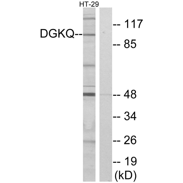 Western Blot - Anti-DGKQ Antibody (C10713) - Antibodies.com
