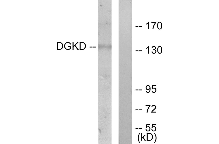Western Blot - Anti-DGKD Antibody (C11140) - Antibodies.com