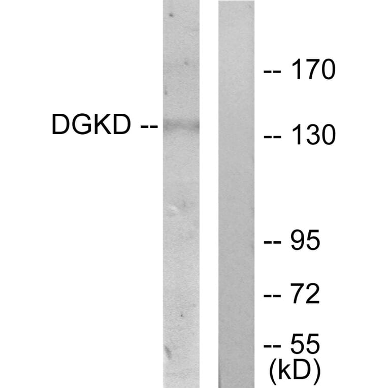 Western Blot - Anti-DGKD Antibody (C11140) - Antibodies.com