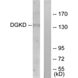 Western Blot - Anti-DGKD Antibody (C11140) - Antibodies.com