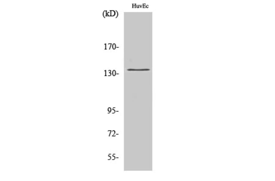 Western Blot - Anti-DGKD Antibody (C11140) - Antibodies.com