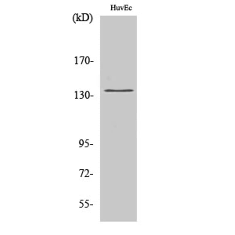 Western Blot - Anti-DGKD Antibody (C11140) - Antibodies.com