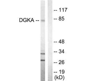 Western Blot - Anti-DGKA Antibody (C10463) - Antibodies.com