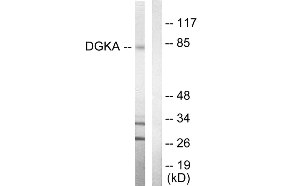 Western Blot - Anti-DGKA Antibody (C10463) - Antibodies.com
