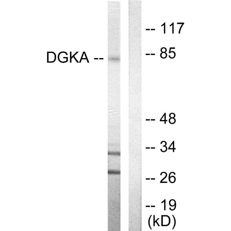 Western Blot - Anti-DGKA Antibody (C10463) - Antibodies.com