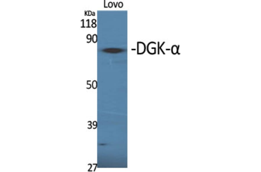 Western Blot - Anti-DGKA Antibody (C10463) - Antibodies.com