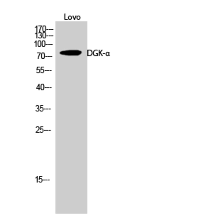 Western Blot - Anti-DGKA Antibody (C10463) - Antibodies.com