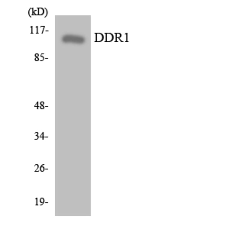 Western Blot - Anti-DDR1 Antibody (R12-2689) - Antibodies.com