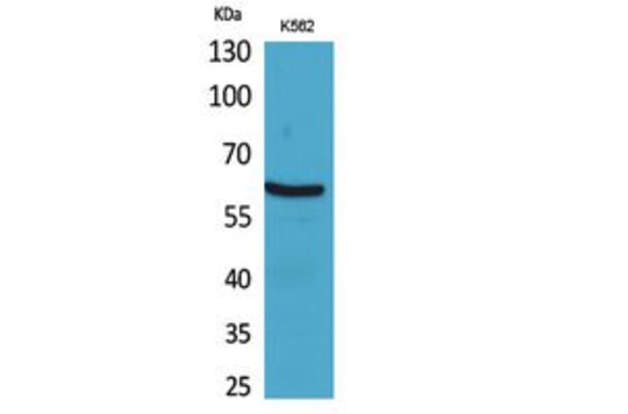 Western Blot - Anti-CYBB Antibody (C30252) - Antibodies.com