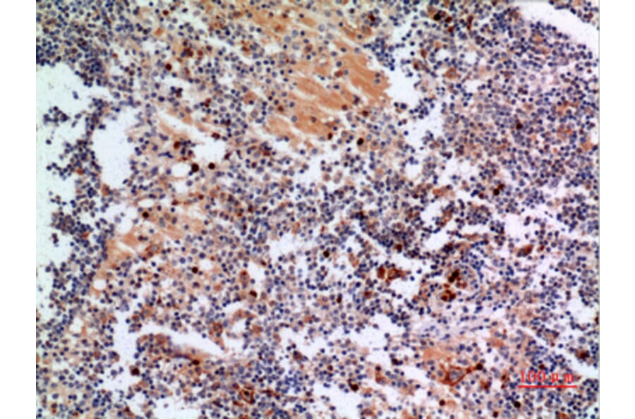 Immunohistochemistry - Anti-CYBB Antibody (C30252) - Antibodies.com