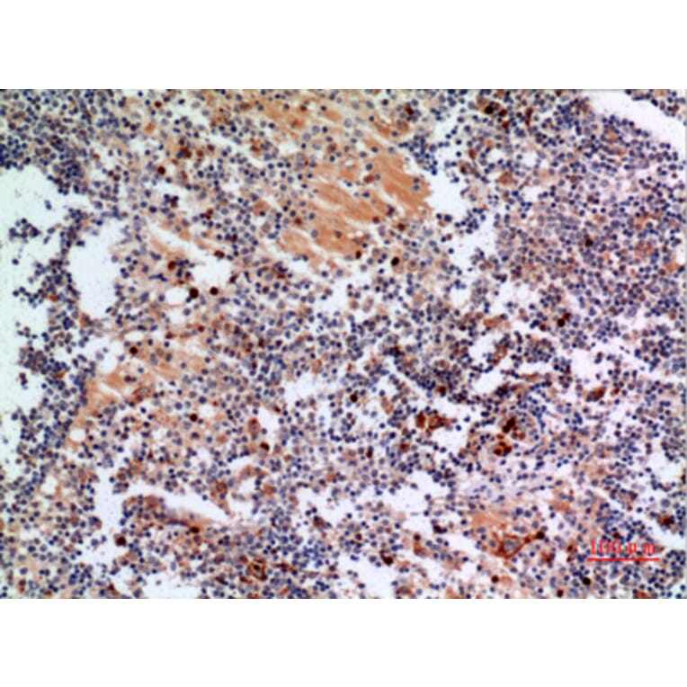 Immunohistochemistry - Anti-CYBB Antibody (C30252) - Antibodies.com