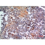 Immunohistochemistry - Anti-CYBB Antibody (C30252) - Antibodies.com