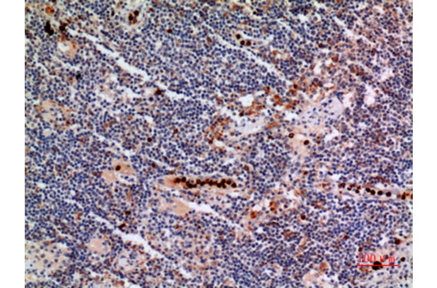 Immunohistochemistry - Anti-CYBB Antibody (C30252) - Antibodies.com