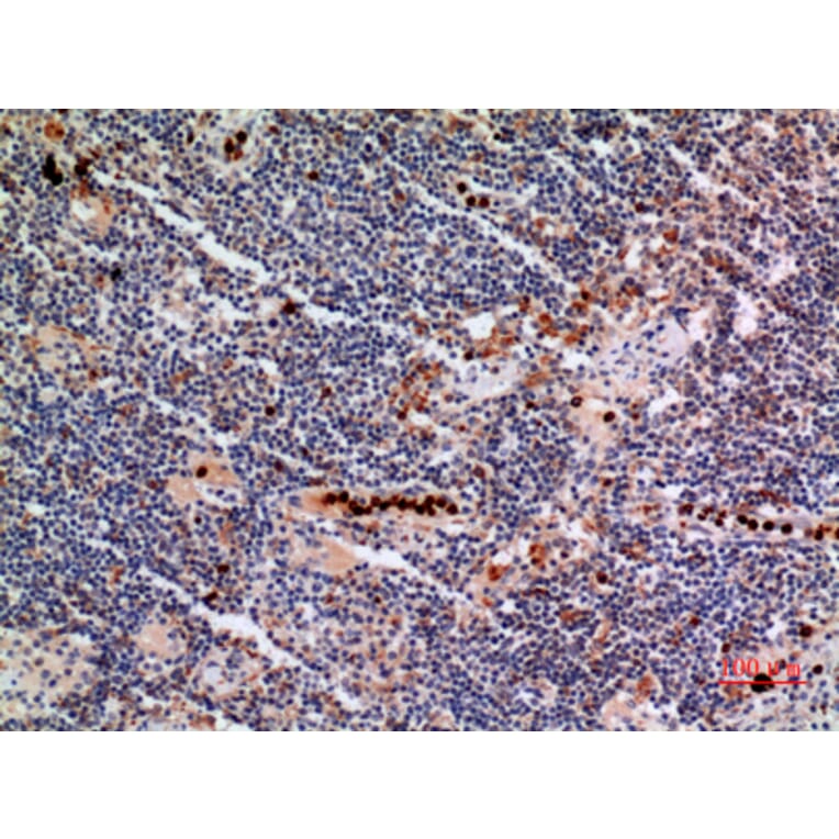Immunohistochemistry - Anti-CYBB Antibody (C30252) - Antibodies.com