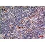 Immunohistochemistry - Anti-CYBB Antibody (C30252) - Antibodies.com