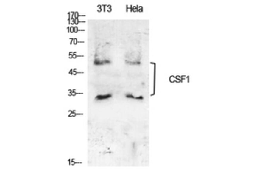 Western Blot - Anti-CSF1 Antibody (C30081) - Antibodies.com
