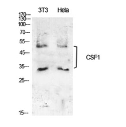 Western Blot - Anti-CSF1 Antibody (C30081) - Antibodies.com