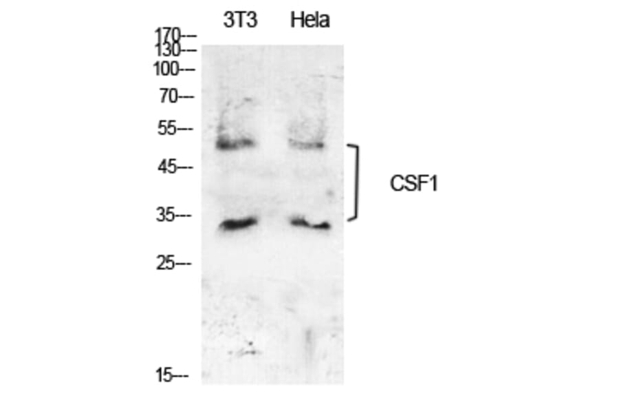 Western Blot - Anti-CSF1 Antibody (C30081) - Antibodies.com