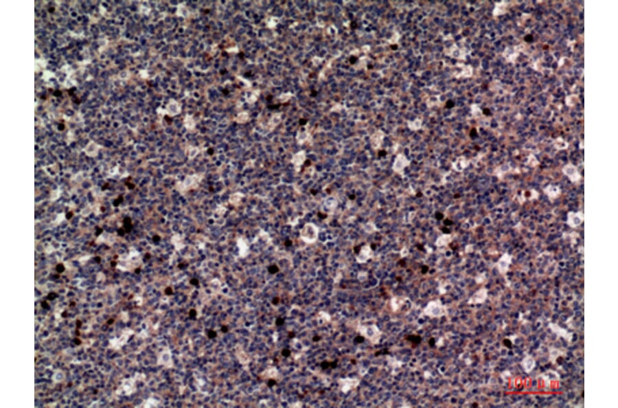 Immunohistochemistry - Anti-CSF1 Antibody (C30081) - Antibodies.com