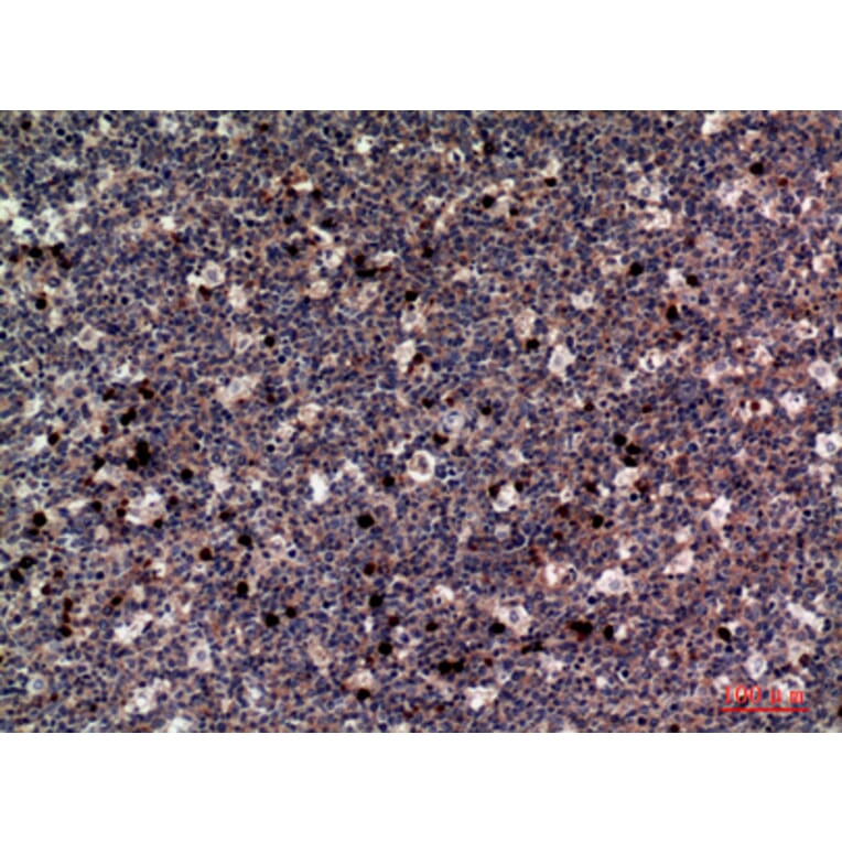 Immunohistochemistry - Anti-CSF1 Antibody (C30081) - Antibodies.com