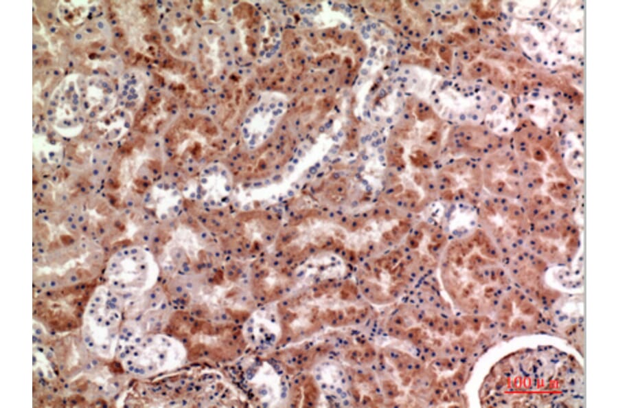 Immunohistochemistry - Anti-CSF1 Antibody (C30081) - Antibodies.com