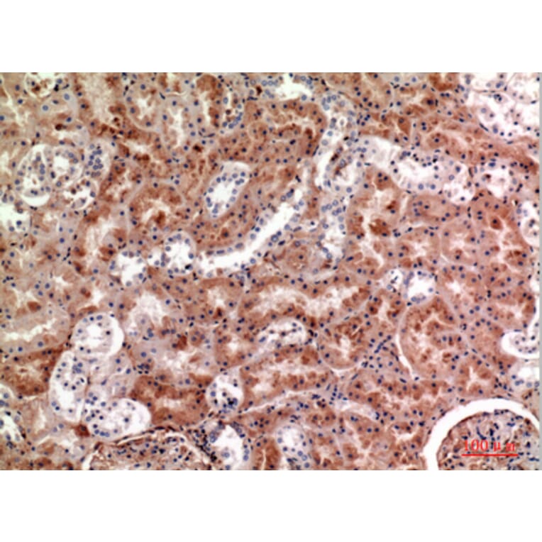 Immunohistochemistry - Anti-CSF1 Antibody (C30081) - Antibodies.com